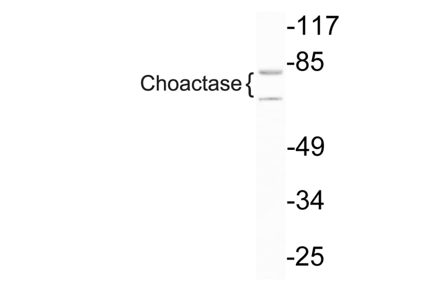 Western Blot - Anti-Choactase Antibody (R12-2092) - Antibodies.com