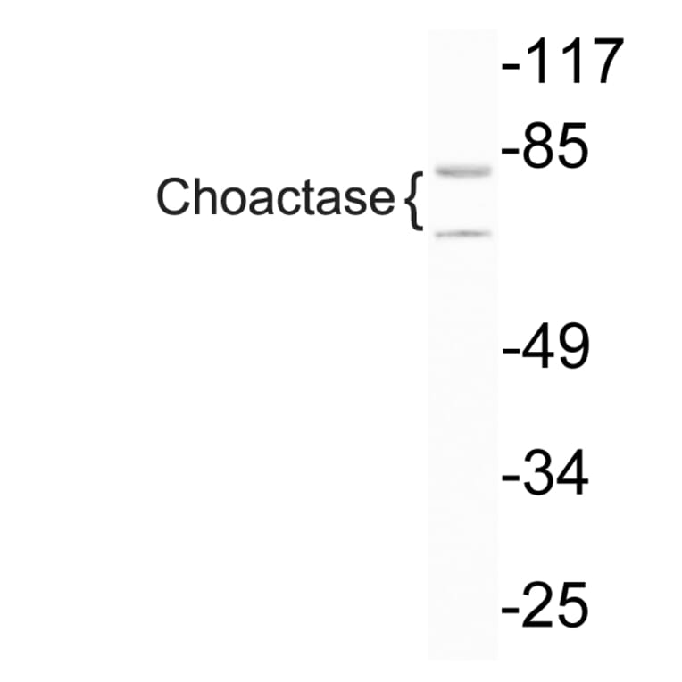 Western Blot - Anti-Choactase Antibody (R12-2092) - Antibodies.com