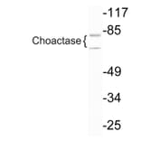 Western Blot - Anti-Choactase Antibody (R12-2092) - Antibodies.com
