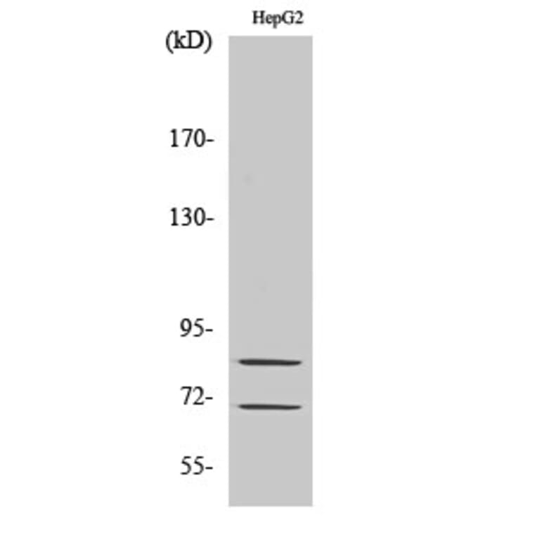 Western Blot - Anti-Choactase Antibody (R12-2092) - Antibodies.com