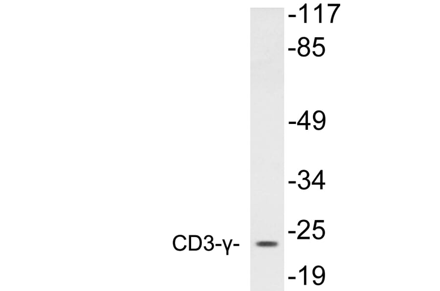 Western Blot - Anti-CD3-gamma Antibody (R12-2076) - Antibodies.com