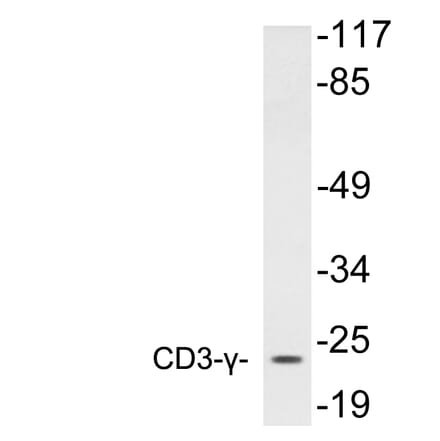 Western Blot - Anti-CD3-gamma Antibody (R12-2076) - Antibodies.com