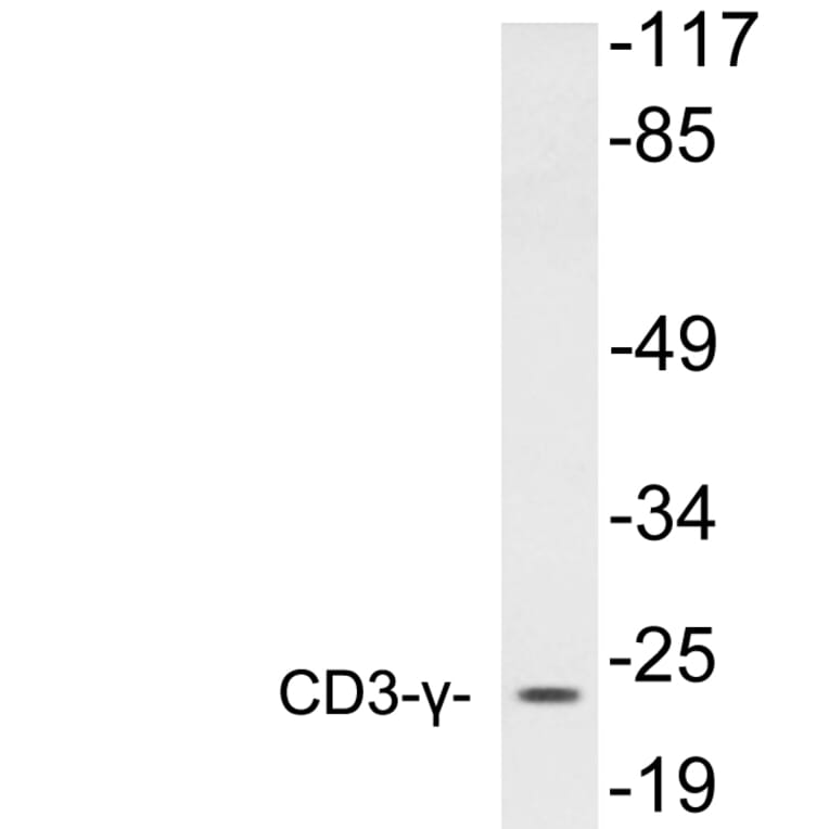 Western Blot - Anti-CD3-gamma Antibody (R12-2076) - Antibodies.com