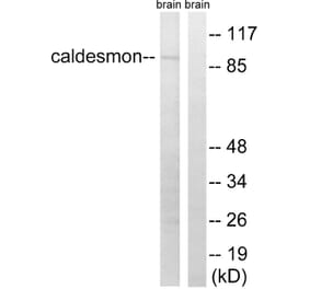 Western Blot - Anti-Caldesmon Antibody (B8309) - Antibodies.com