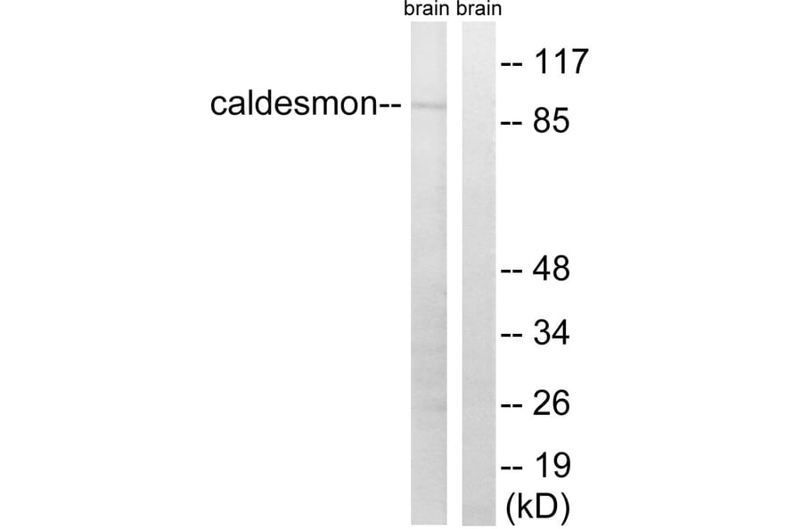 Western Blot - Anti-Caldesmon Antibody (B8309) - Antibodies.com