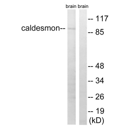 Western Blot - Anti-Caldesmon Antibody (B8309) - Antibodies.com