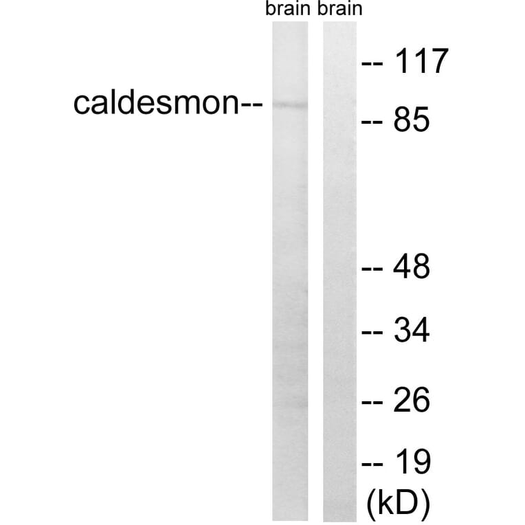 Western Blot - Anti-Caldesmon Antibody (B8309) - Antibodies.com