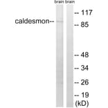 Western Blot - Anti-Caldesmon Antibody (B8309) - Antibodies.com