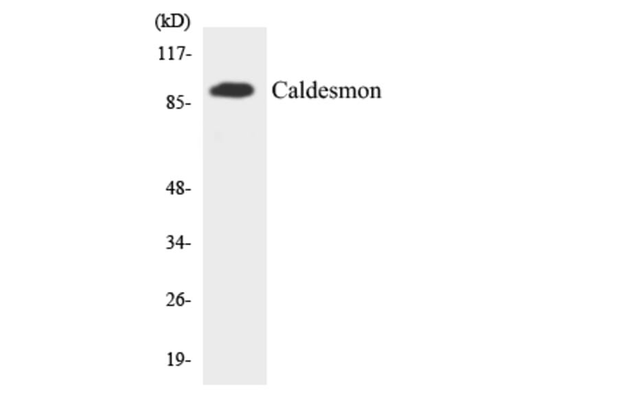 Western Blot - Anti-Caldesmon Antibody (R12-2566) - Antibodies.com