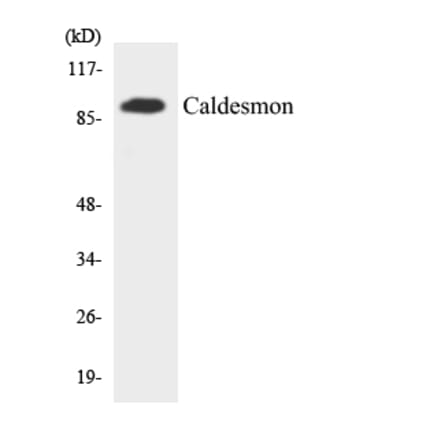 Western Blot - Anti-Caldesmon Antibody (R12-2566) - Antibodies.com