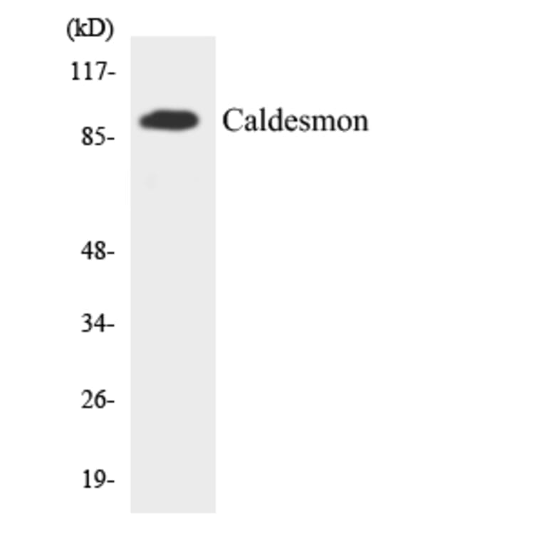 Western Blot - Anti-Caldesmon Antibody (R12-2566) - Antibodies.com
