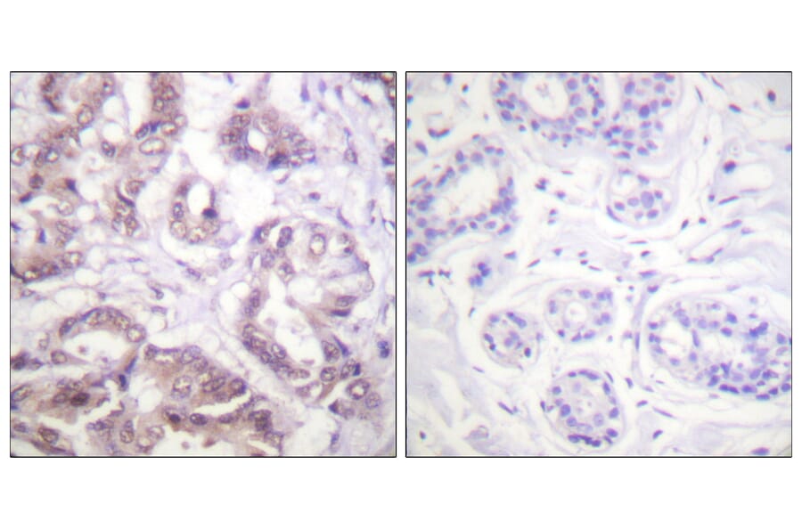 Immunohistochemistry - Anti-Survivin Antibody (B0578) - Antibodies.com