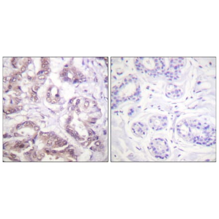 Immunohistochemistry - Anti-Survivin Antibody (B0578) - Antibodies.com