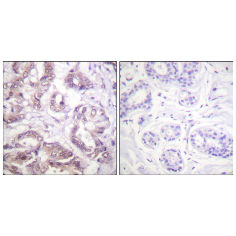 Immunohistochemistry - Anti-Survivin Antibody (B0578) - Antibodies.com