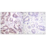 Immunohistochemistry - Anti-Survivin Antibody (B0578) - Antibodies.com