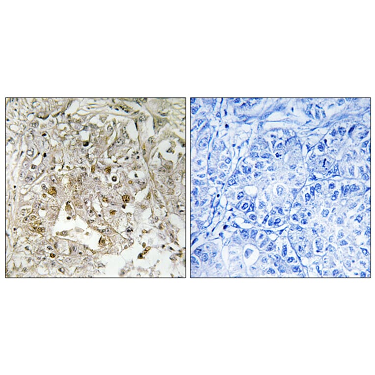 Immunohistochemistry - Anti-p38 MAPK Antibody (B0799) - Antibodies.com