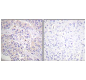 Immunohistochemistry - Anti-p130 Cas Antibody (B0695) - Antibodies.com