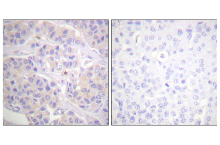 Immunohistochemistry - Anti-p130 Cas Antibody (B0695) - Antibodies.com