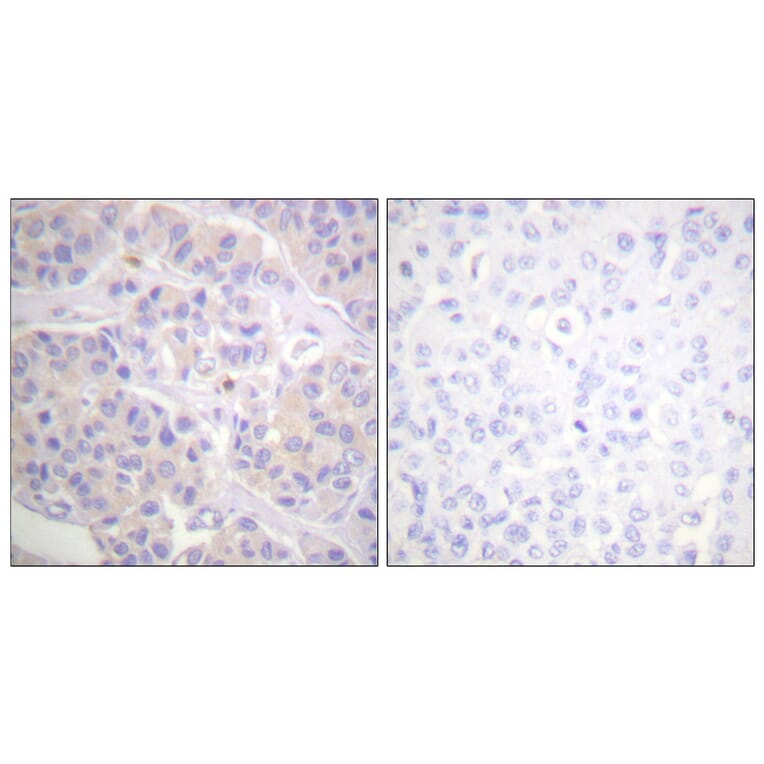 Immunohistochemistry - Anti-p130 Cas Antibody (B0695) - Antibodies.com