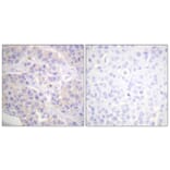 Immunohistochemistry - Anti-p130 Cas Antibody (B0695) - Antibodies.com