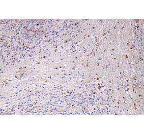 Immunohistochemistry - Anti-GROalpha Antibody (R12-2171) - Antibodies.com