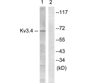 Western Blot - Anti-KCNC4 Antibody (B1087) - Antibodies.com