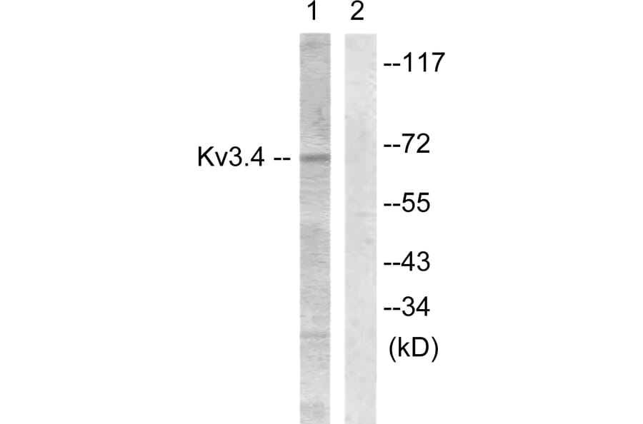 Western Blot - Anti-KCNC4 Antibody (B1087) - Antibodies.com