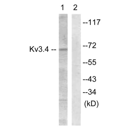 Western Blot - Anti-KCNC4 Antibody (B1087) - Antibodies.com