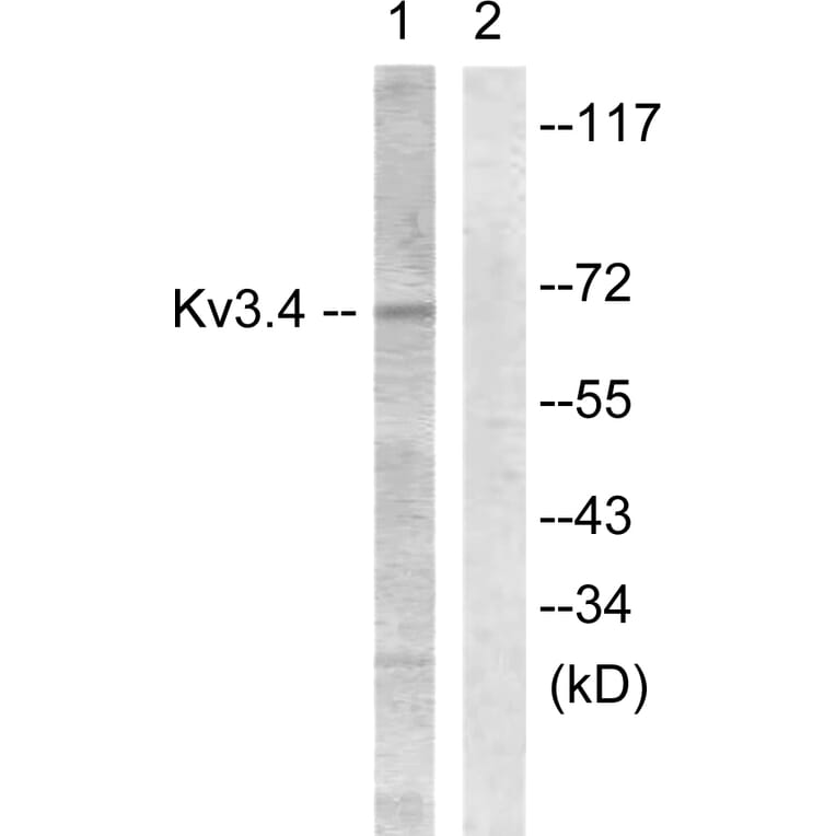 Western Blot - Anti-KCNC4 Antibody (B1087) - Antibodies.com