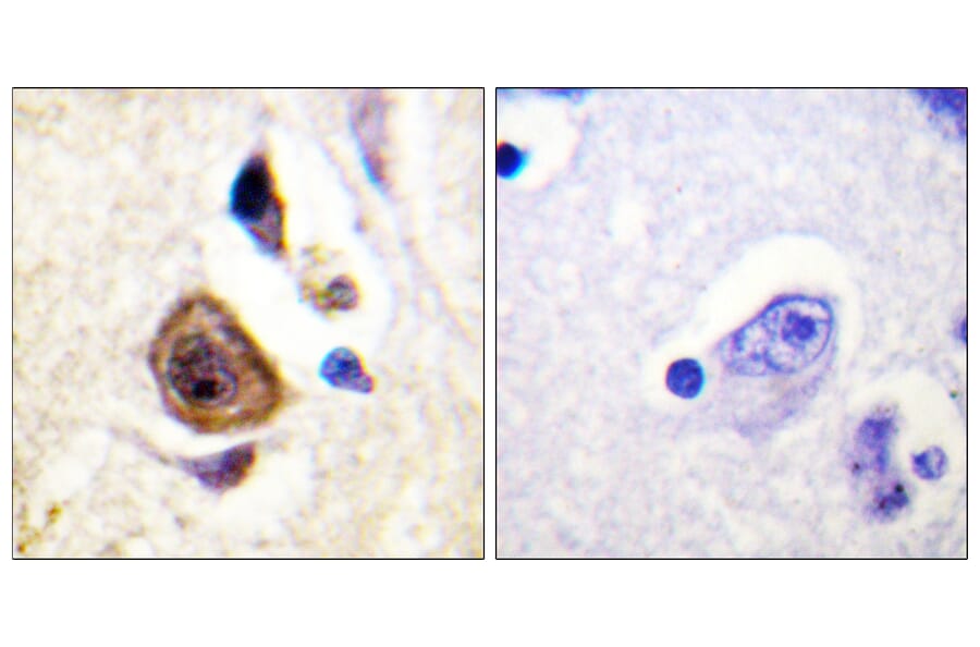 Immunohistochemistry - Anti-KCNC4 Antibody (B1087) - Antibodies.com