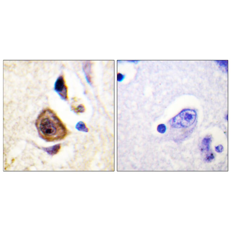 Immunohistochemistry - Anti-KCNC4 Antibody (B1087) - Antibodies.com