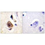 Immunohistochemistry - Anti-KCNC4 Antibody (B1087) - Antibodies.com