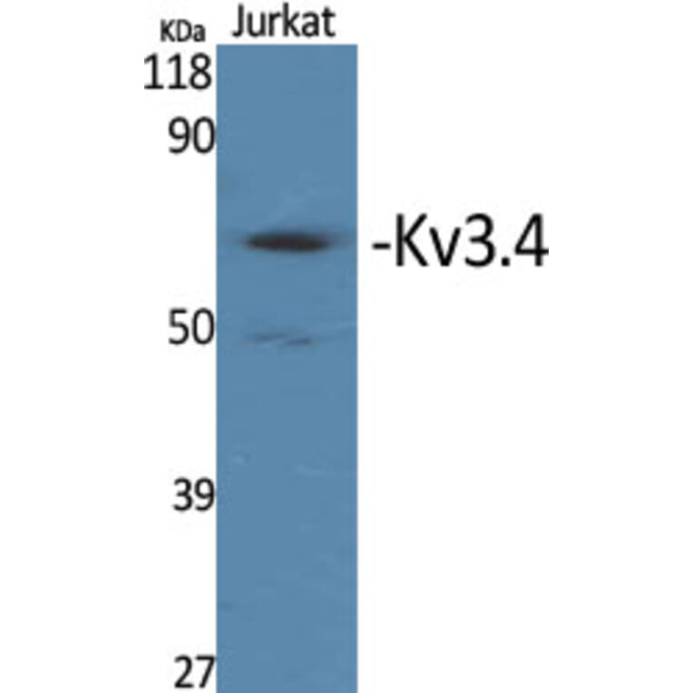 Western Blot - Anti-KCNC4 Antibody (B1087) - Antibodies.com