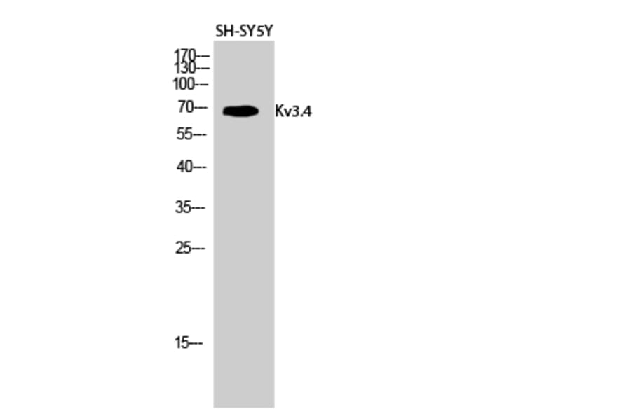 Western Blot - Anti-KCNC4 Antibody (B1087) - Antibodies.com