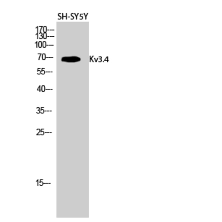 Western Blot - Anti-KCNC4 Antibody (B1087) - Antibodies.com