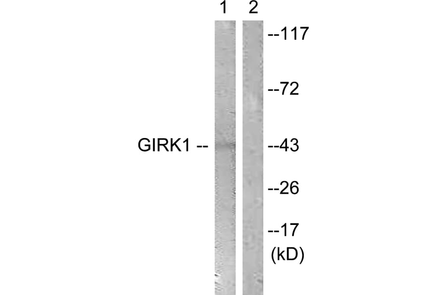 Western Blot - Anti-GIRK1 Antibody (B1030) - Antibodies.com