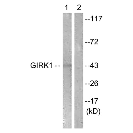 Western Blot - Anti-GIRK1 Antibody (B1030) - Antibodies.com