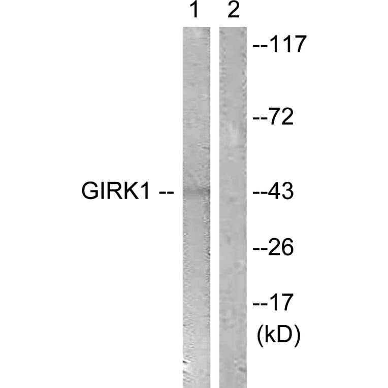 Western Blot - Anti-GIRK1 Antibody (B1030) - Antibodies.com