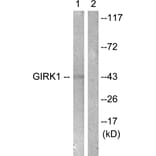 Western Blot - Anti-GIRK1 Antibody (B1030) - Antibodies.com