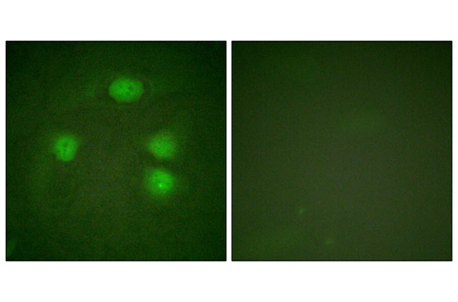Immunofluorescence - Anti-GIRK1 Antibody (B1030) - Antibodies.com