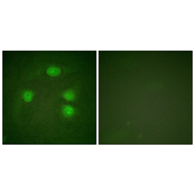 Immunofluorescence - Anti-GIRK1 Antibody (B1030) - Antibodies.com