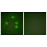 Immunofluorescence - Anti-GIRK1 Antibody (B1030) - Antibodies.com