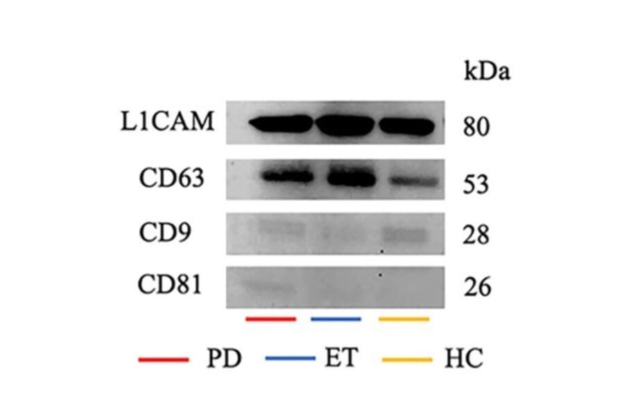 Western Blot - Anti-CD171 Antibody (A96018) - Publication