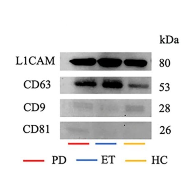 Western Blot - Anti-CD171 Antibody (A96018) - Publication