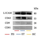 Western Blot - Anti-CD171 Antibody (A96018) - Publication