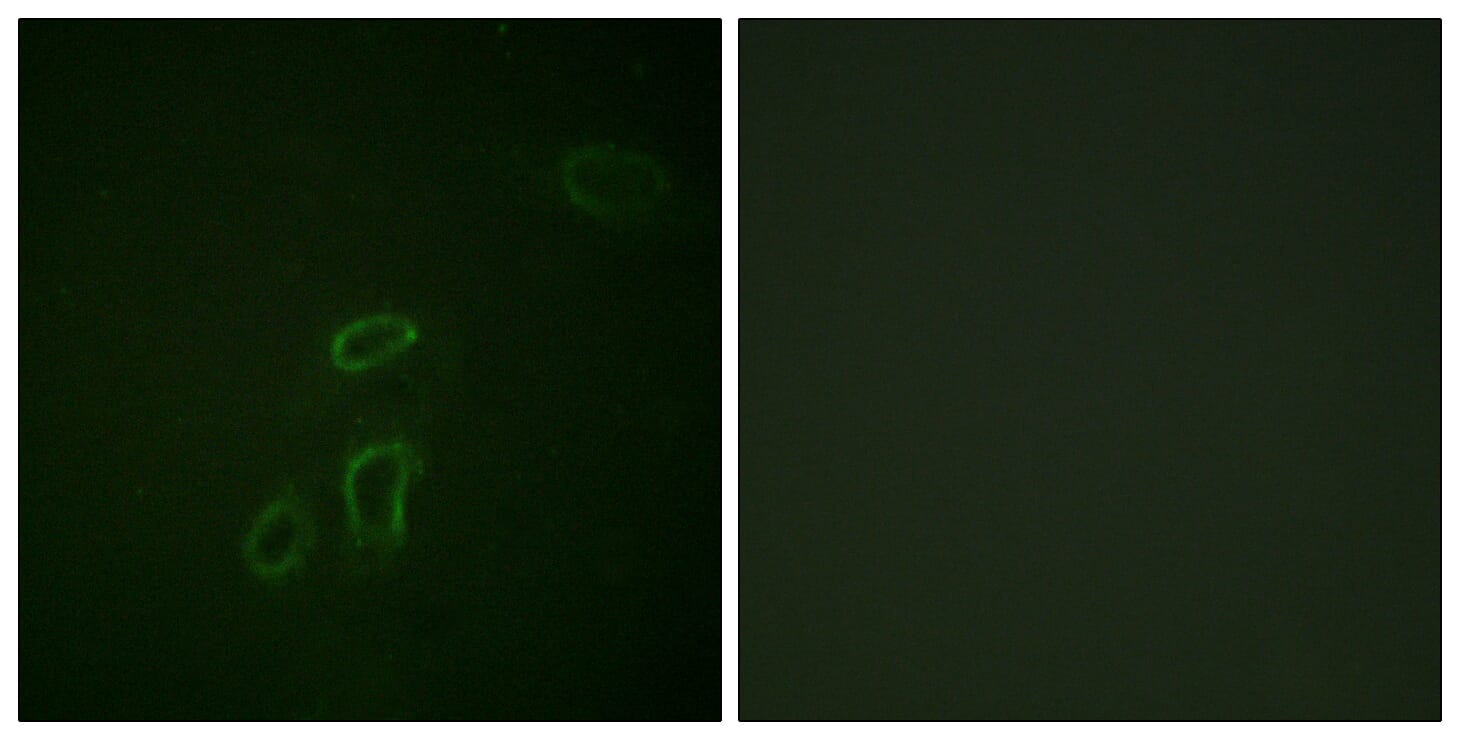 Immunofluorescence analysis of HepG2 cells using Anti-CD171 Antibody. The right hand panel represents a negative control, where the antibody was pre-incubated with the immunising peptide.