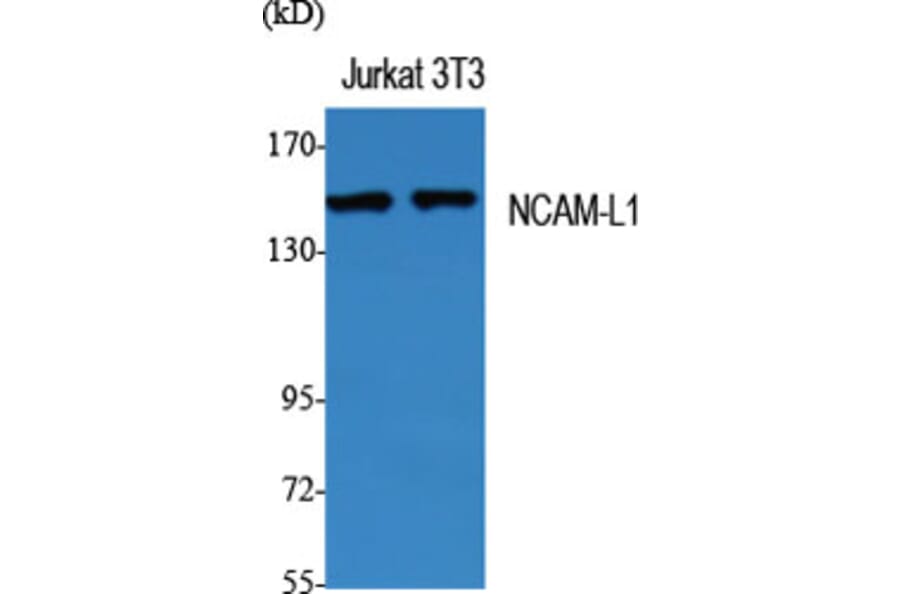 Western Blot - Anti-CD171 Antibody (B0841) - Antibodies.com