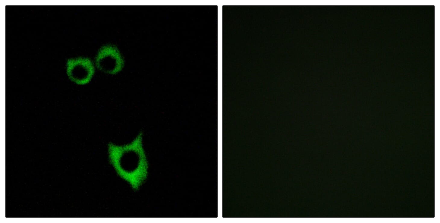 Immunofluorescence analysis of MCF7 cells using Anti-VIPR2 Antibody. The right hand panel represents a negative control, where the antibody was pre-incubated with the immunising peptide.