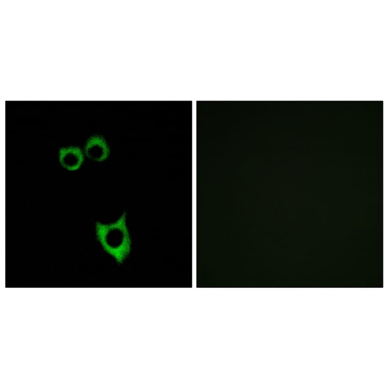 Immunofluorescence - Anti-VIPR2 Antibody (G790) - Antibodies.com