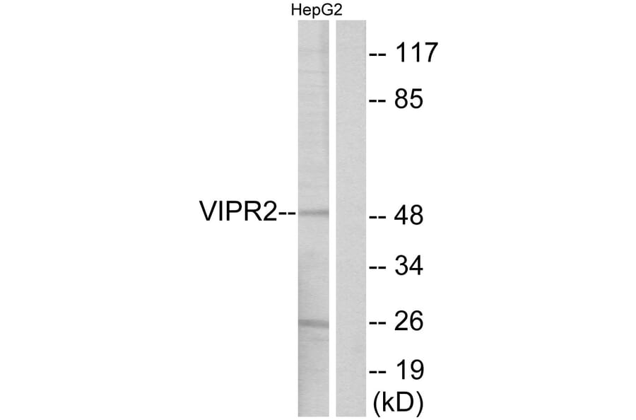 Western Blot - Anti-VIPR2 Antibody (G790) - Antibodies.com